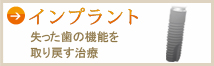インプラント